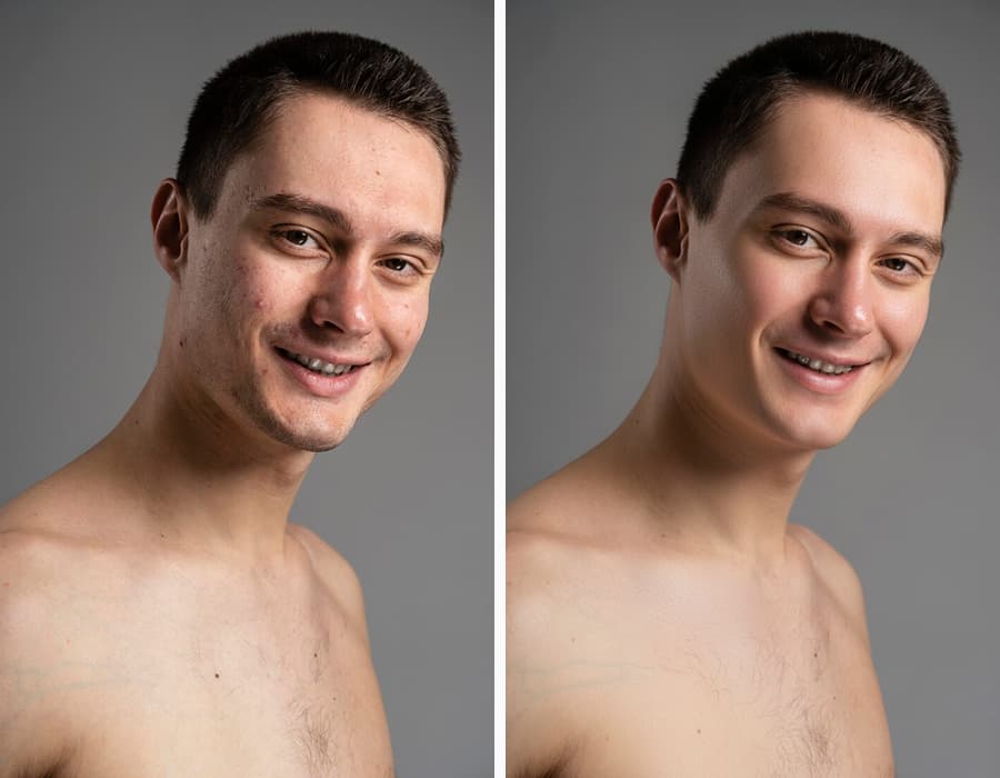 Natural Wrinkle Softening