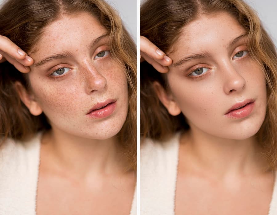 Total Skin Enhancement