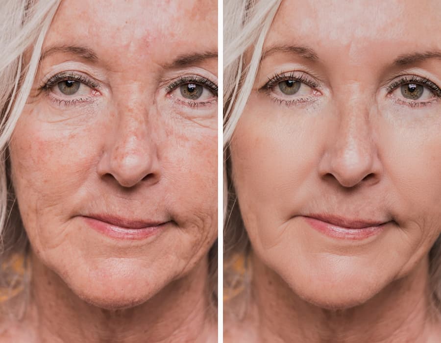 A before-and-after image showing a woman's face. The left side shows visible wrinkles and uneven skin tone, while the right side shows the same face with smoother, brighter skin.