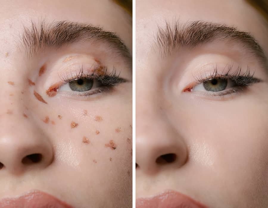 A close-up portrait of a person with perfectly smooth skin after blemishes and stray hairs were removed.