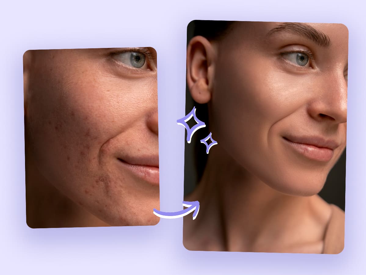 A before-and-after photo showing a woman's face. The 'before' image on the left shows freckles and blemishes, while the 'after' image on the right displays clear, smooth skin with the imperfections removed by AI.