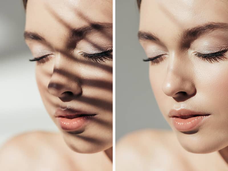 A before-and-after split image of a woman's face. The 'before' side on the left shows her face partially covered by a strong, striped shadow from a plant. The 'after' side on the right shows her face perfectly lit and clear, with the shadow completely removed.